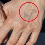 Why are your veins suddenly bulging and visible?