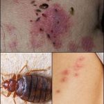 BE CAREFUL, If you spot these dots on your skin, it means you have Ca…