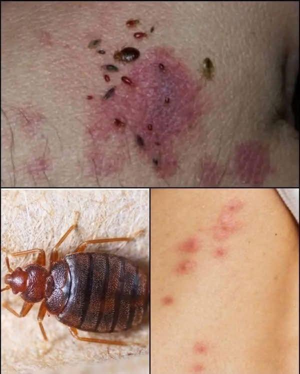 BE CAREFUL, If you spot these dots on your skin, it means you have Ca…