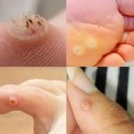 Be very careful if it comes out in your mouth, you are…