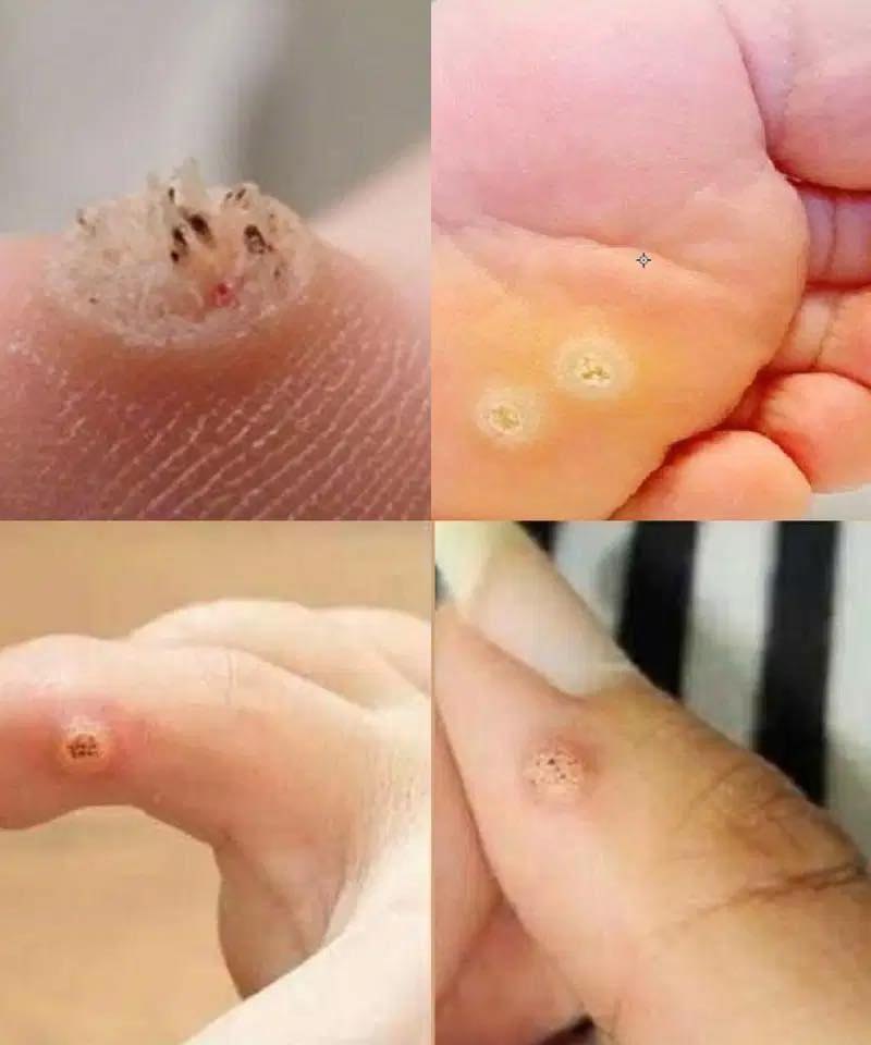 Be very careful if it comes out in your mouth, you are…