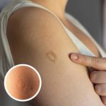 Here’s The Truth Behind This Scar On People’s Upper Left Arm