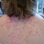 These are the consequences of sleeping with…