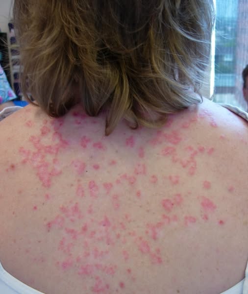 These are the consequences of sleeping with…