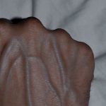 If your veins are visible in your hand, it is a signal of ca…