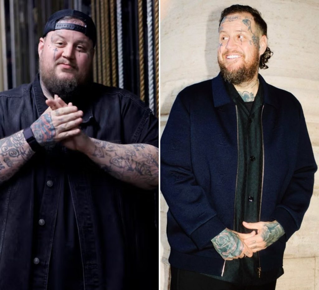 After Losing 200 Pounds, Jelly Roll Is Eligible to Wear Louis Vuitton and Stuns Fans