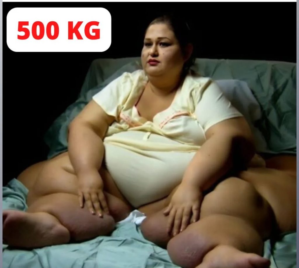 After shedding nearly 400 kg and leaving her husband, this woman looks completely unrecognizable.